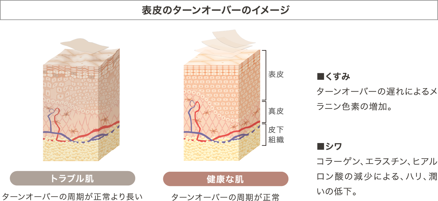 肌トラブルの原因