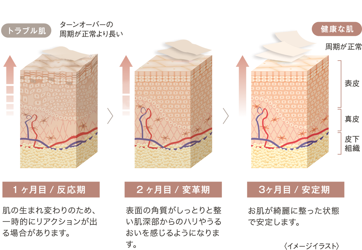 短期間で変化が実感できるからリピートへ