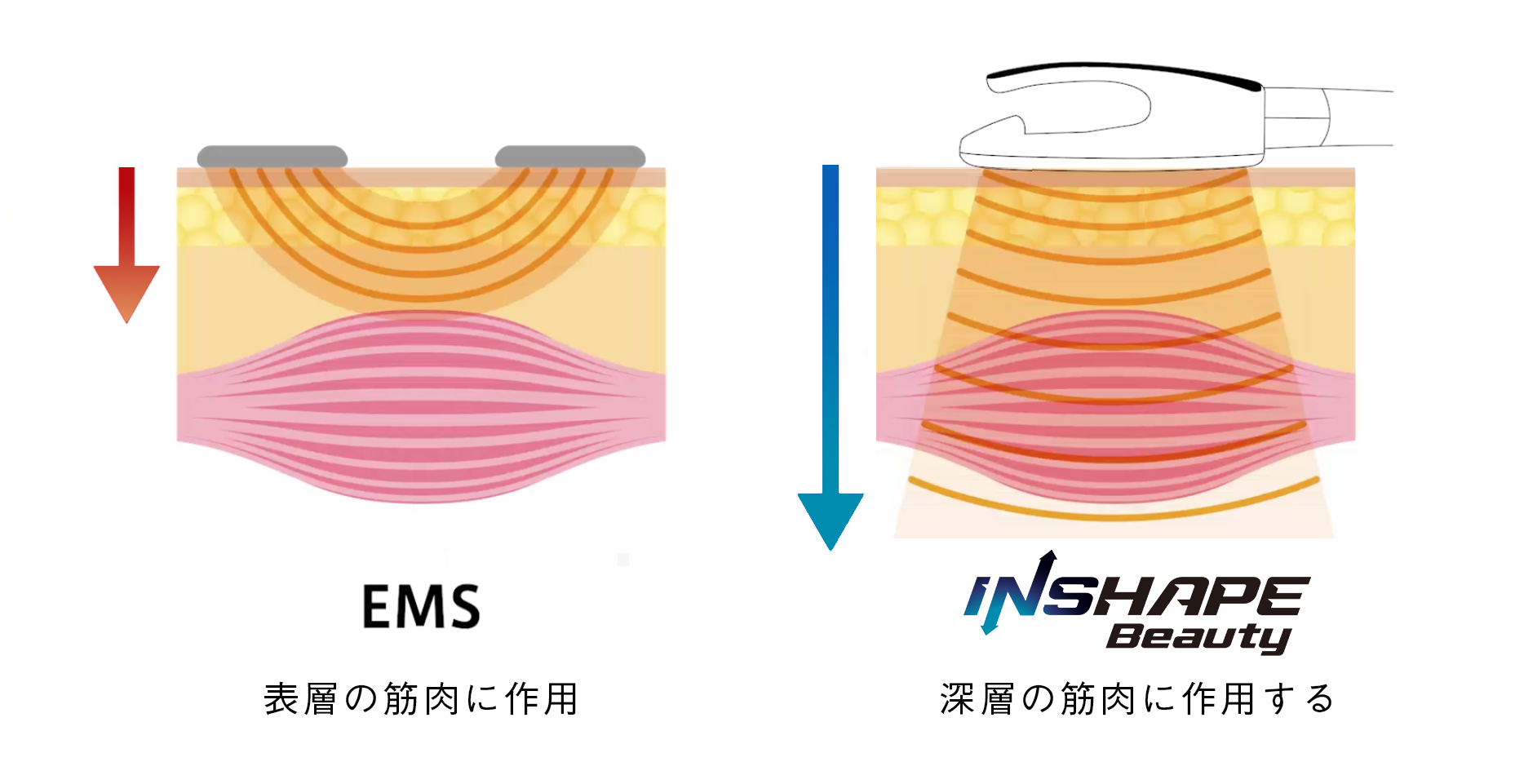 電磁波パルス